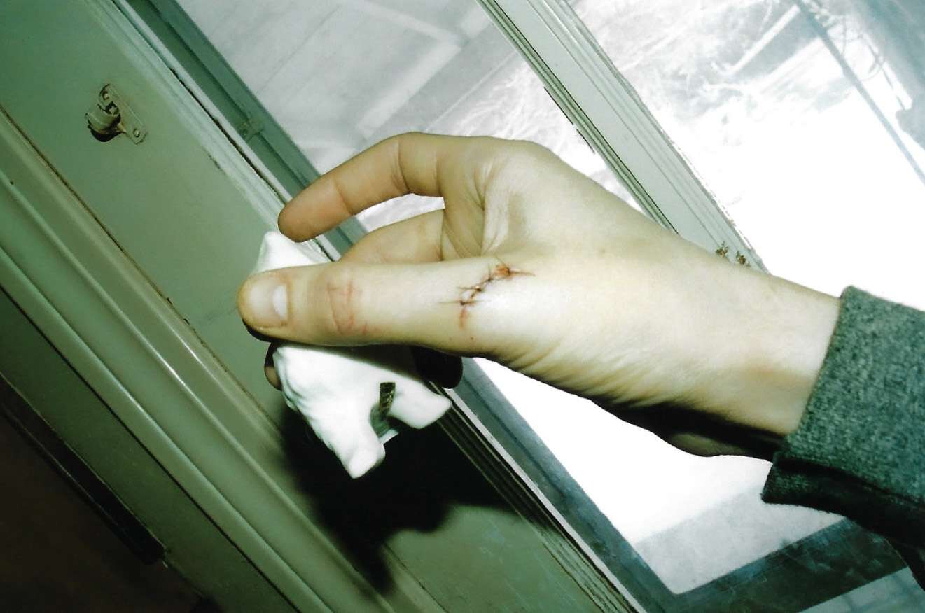 Wounded